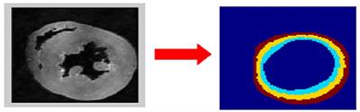 Transmural Remodeling of Cardiac Microstructure in Aged Spontaneously Hypertensive Rats by Diffusion Tensor MRI